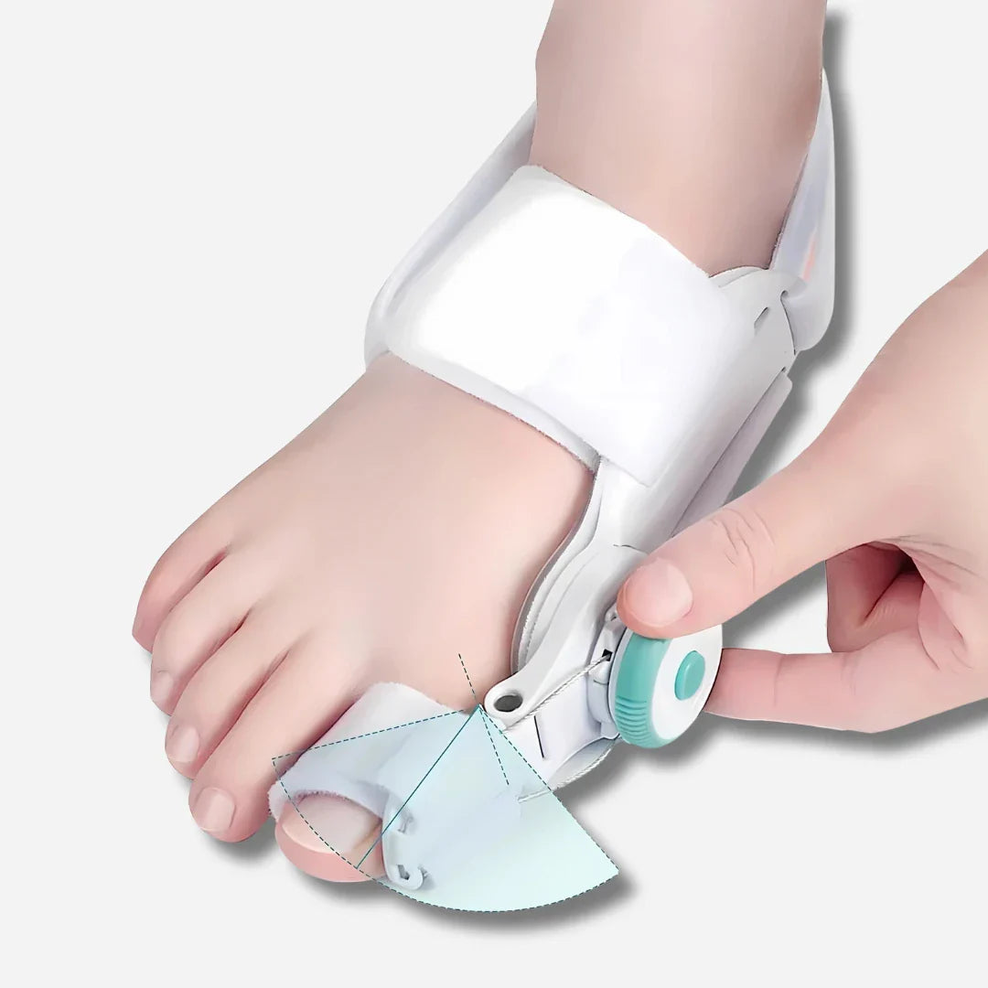 Nextpair | Justerbar tåkorrektor til hallux valgus og bunion korrektion